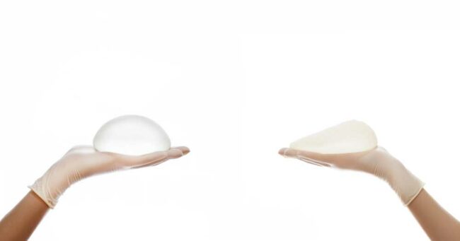 Breast Implant Removal Surgery